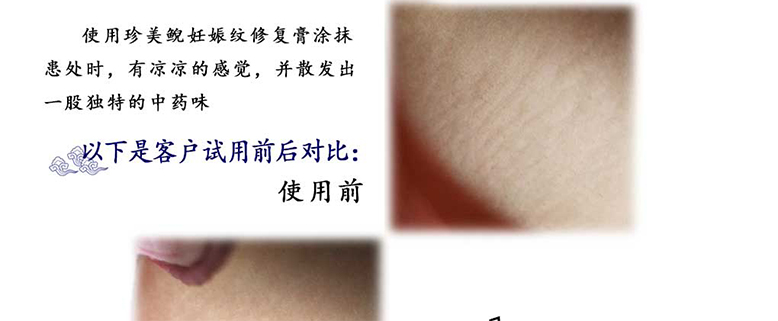 走魚(yú)妊娠紋修復(fù)套裝1_07.jpg